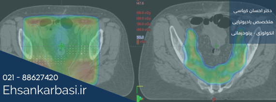 پرتودرمانی چیست و چگونه انجام میشود