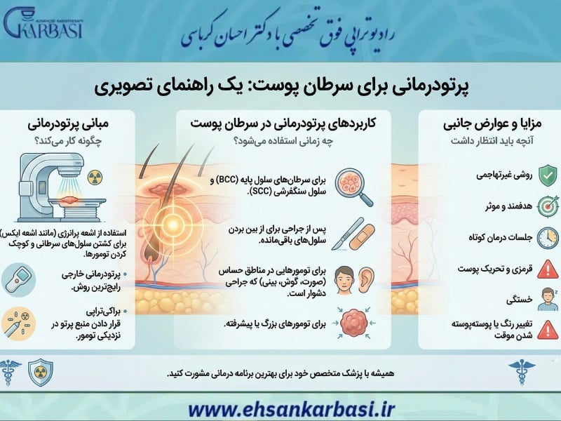 پرتو درمانی سرطان پوست