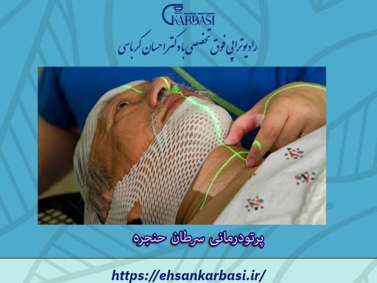 پرتودرمانی برای سرطان حنجره و هیپوفارنکس چگونه است؟ 2 پرتودرمانی سرطان حنجره