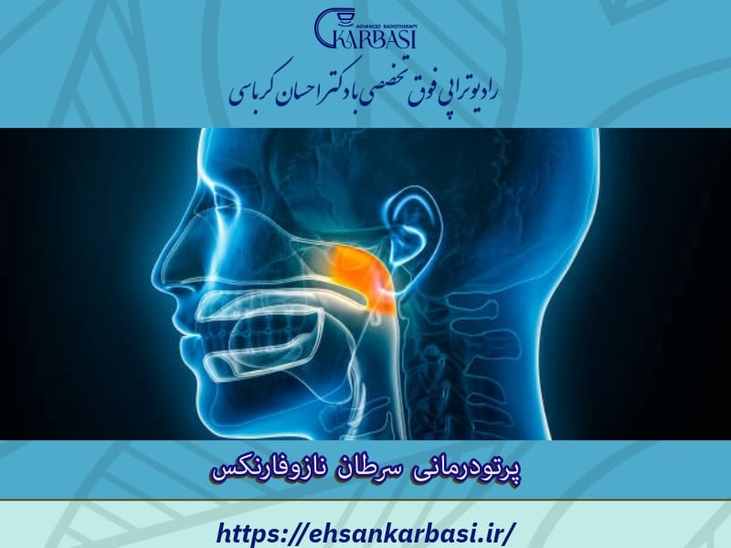 پرتودرمانی سرطان نازوفارنکس