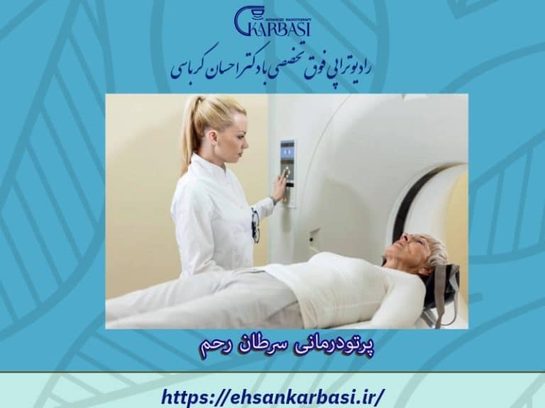 پرتودرمانی یا رادیوتراپی رحم | درمان قطعی سرطان آندومتر 2 پرتو درمانی سرطان رحم