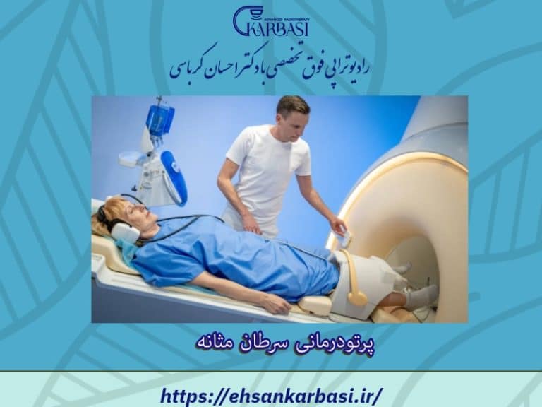 رادیوتراپی یا پرتو درمانی موثرترین روش درمان سرطان مثانه 2 پرتو درمانی سرطان مثانه