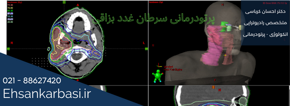 رادیوتراپی غدد بزاقی