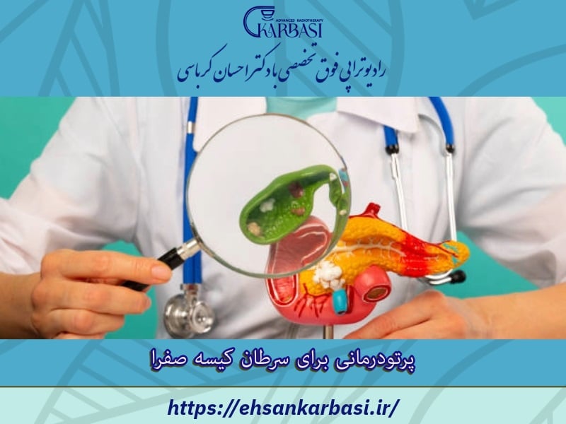 پرتودرمانی برای سرطان کیسه صفرا