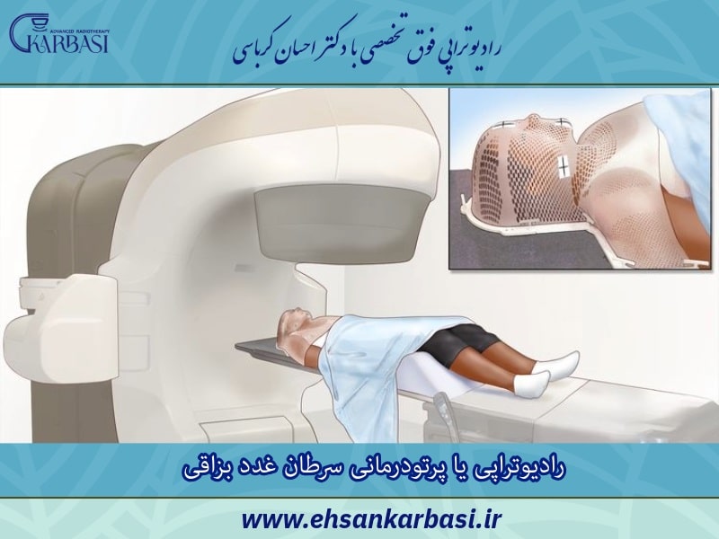 رادیوتراپی یا پرتودرمانی سرطان غدد بزاقی