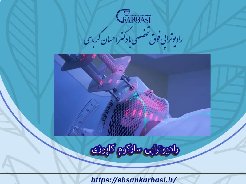 رادیوتراپی سارکوم کاپوزی