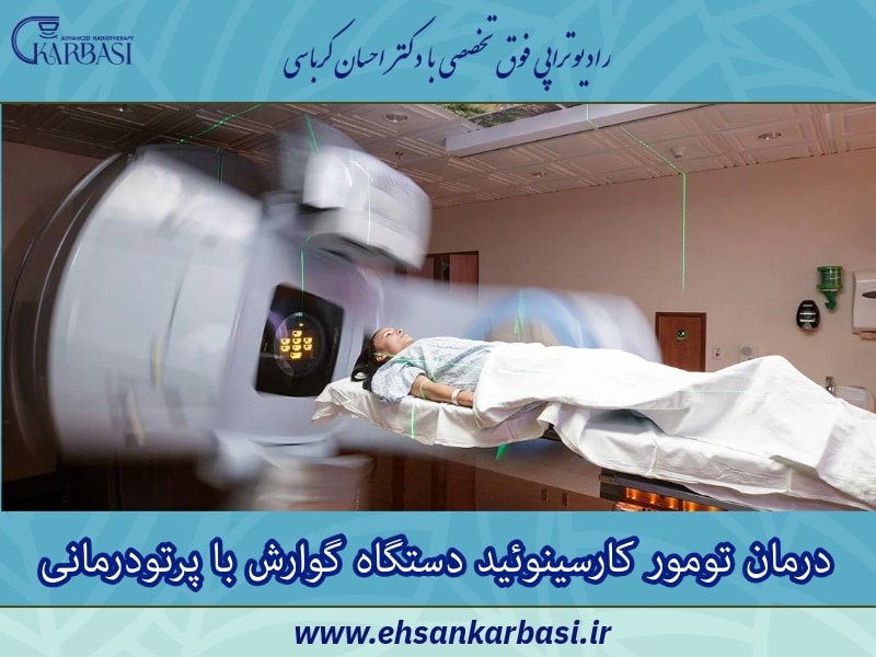 درمان تومور کارسینوئید دستگاه گوارش با پرتودرمانی