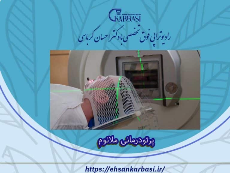 پرتودرمانی ملانوم 2 پرتودرمانی ملانوم