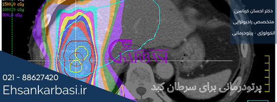 عوارض پرتودرمانی سرطان کبد