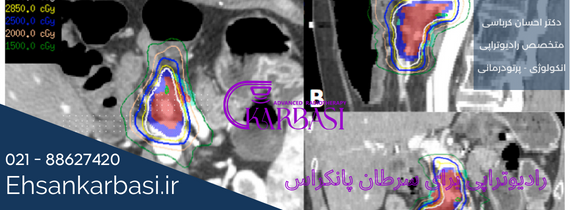 عوارض پرتودرمانی سرطان پانکراس