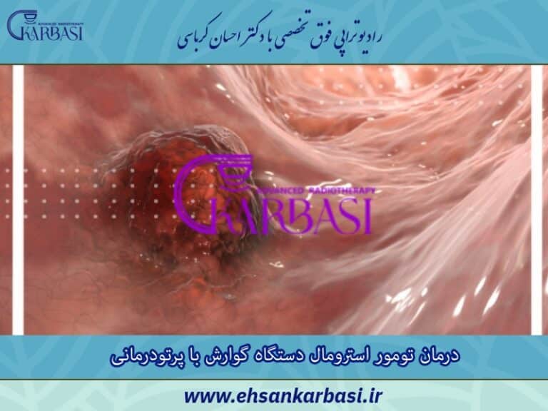 درمان تومور استرومال دستگاه گوارش با پرتودرمانی یا رادیوتراپی 2 درمان تومور استرومال دستگاه گوارش با پرتودرمانی