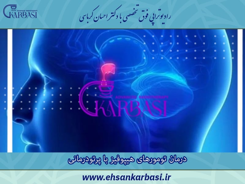 درمان تومورهای هیپوفیز با پرتودرمانی