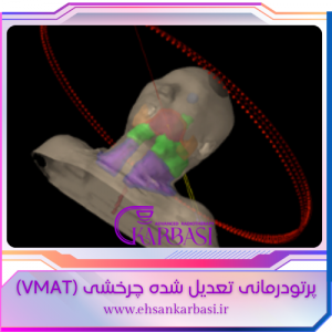 رادیوتراپی تعدیل شده چرخشی