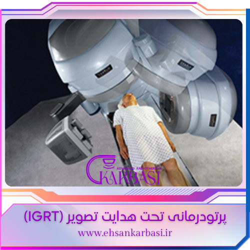 پرتودرمانی IGRT