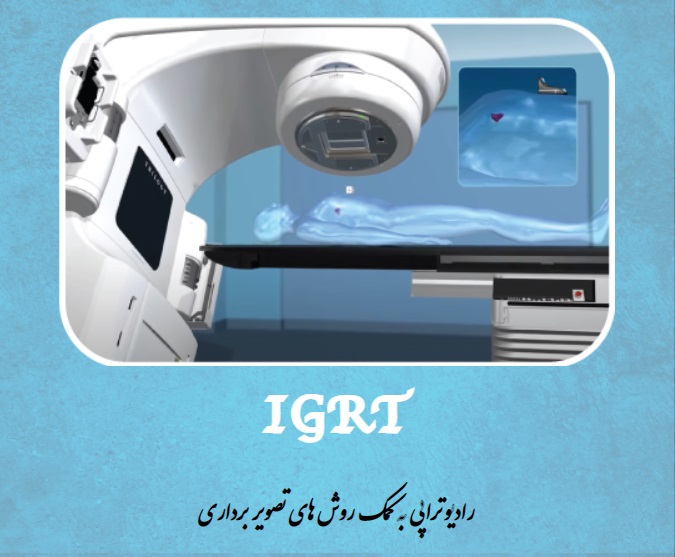 رادیوتراپی به کمک روش های تصویر برداری IGRT