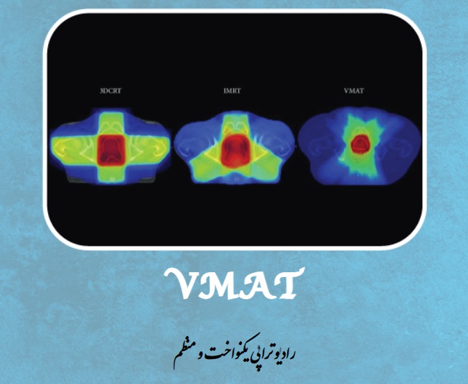 رادیوتراپی یکنواخت و منظم VMAT