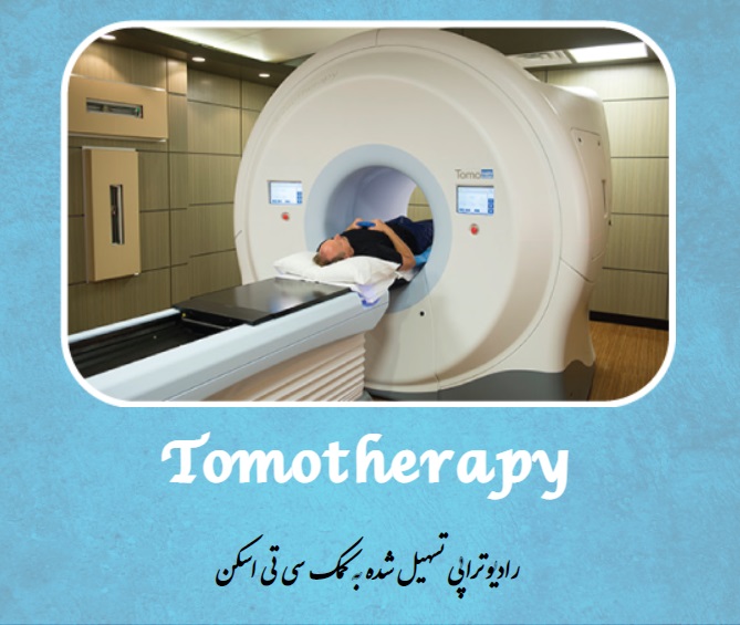 رادیوتراپی تسهیل شده به کمک سی تی اسکن Tomotherapy
