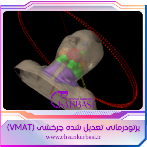 رادیوتراپی VMAT
