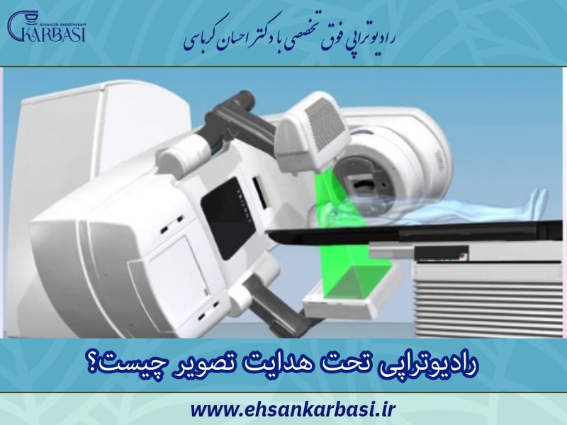 رادیوتراپی تحت هدایت تصویر IGRT چیست؟