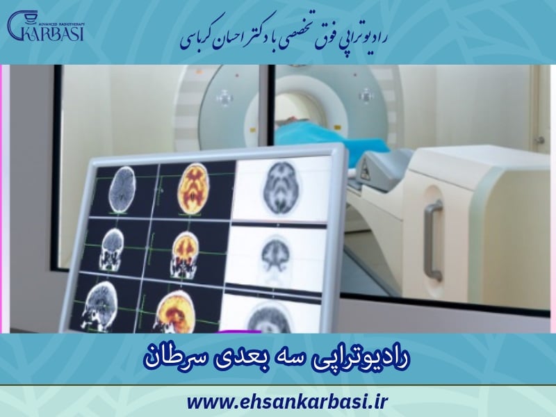 رادیوتراپی سه بعدی (3D-CRT): دقت بالا در درمان سرطان
