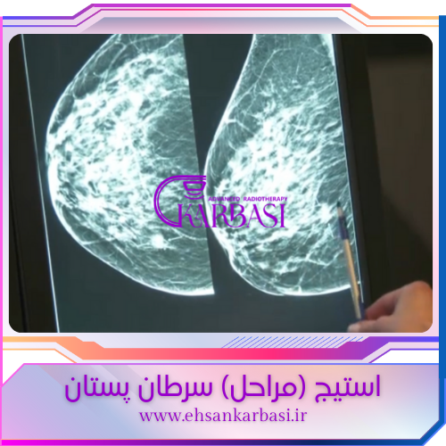 مرحله سرطان پستان
