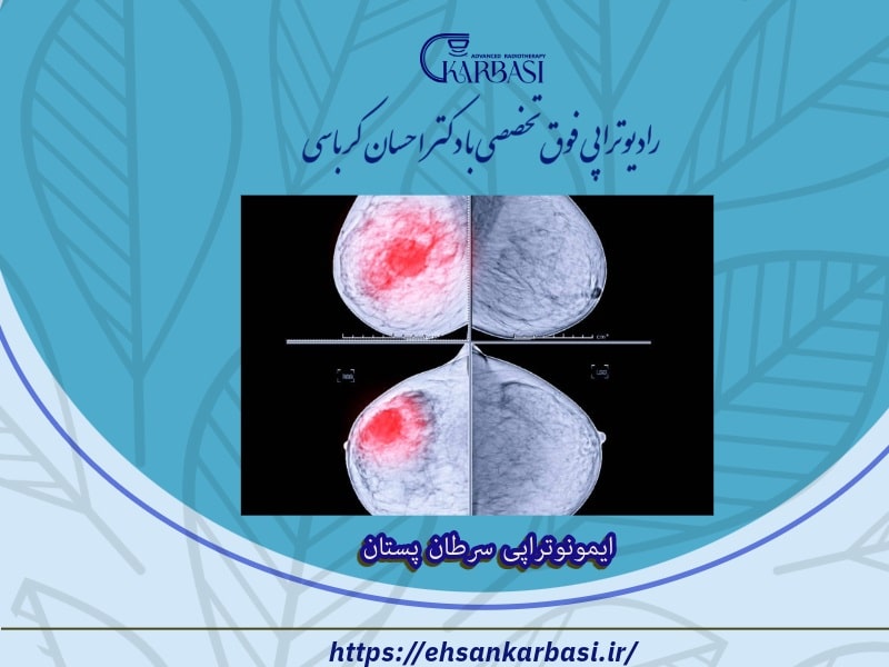 ایمونوتراپی سرطان پستان