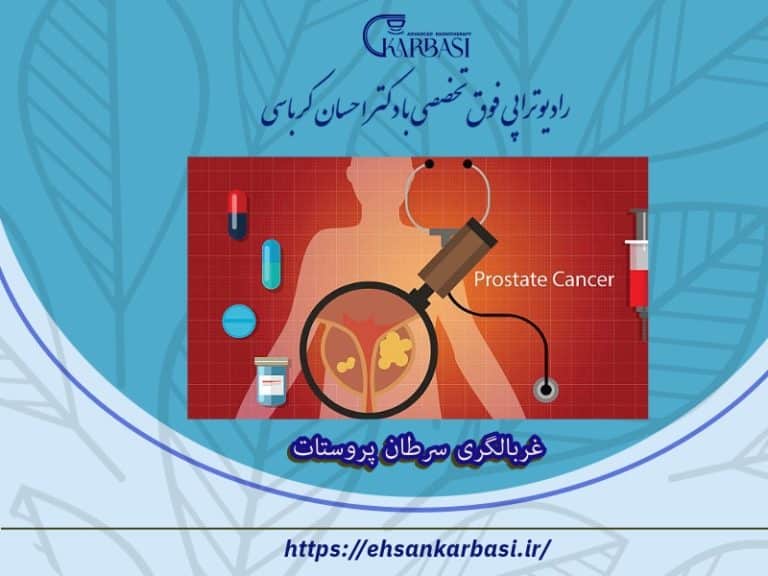 غربالگری سرطان پروستات 2 غربالگری سرطان پروستات