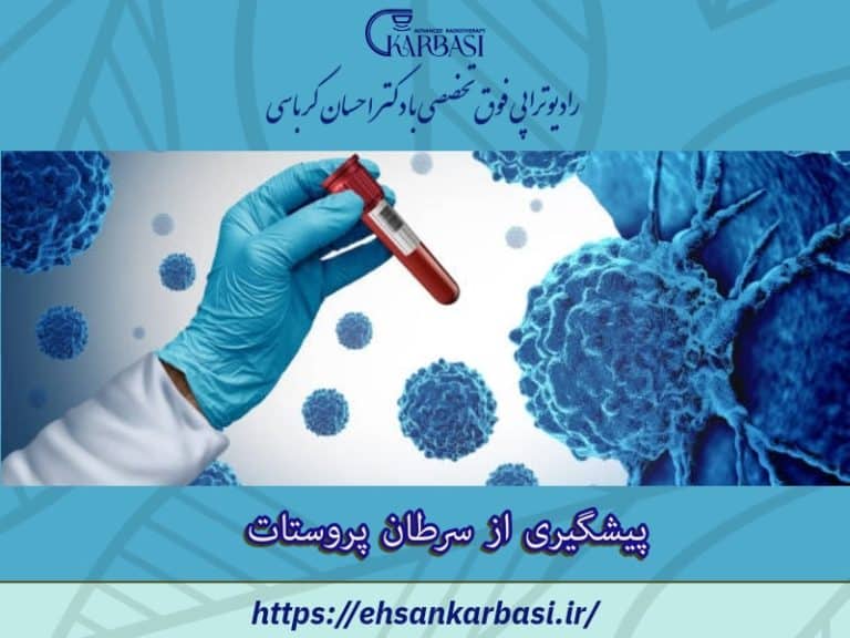 آیا می توان از سرطان پروستات پیشگیری کرد؟ 2 پیشگیری از سرطان پروستات