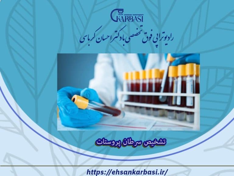 تشخیص سرطان پروستات 2 تشخیص سرطان پروستات