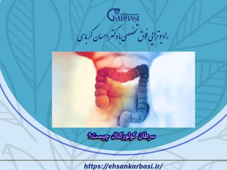 سرطان کولورکتال چیست؟ 2 سرطان کولورکتال