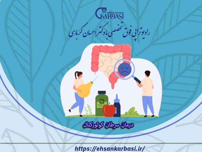 انواع درمان های سرطان کولورکتال (کولون و رکتوم) 2 درمان سرطان کولورکتال