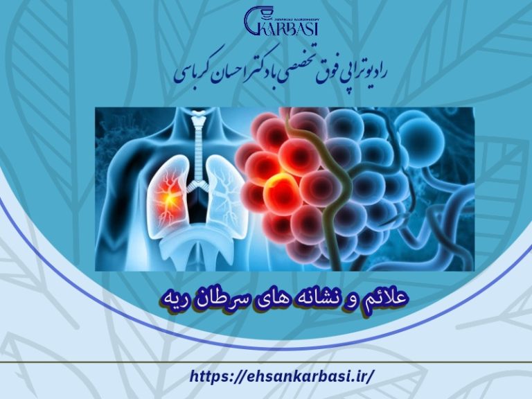 علائم و نشانه های سرطان ریه 2 علائم و نشانه های سرطان ریه