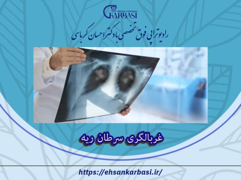 غربالگری سرطان ریه با سی تی اسکن 2 غربالگری سرطان ریه