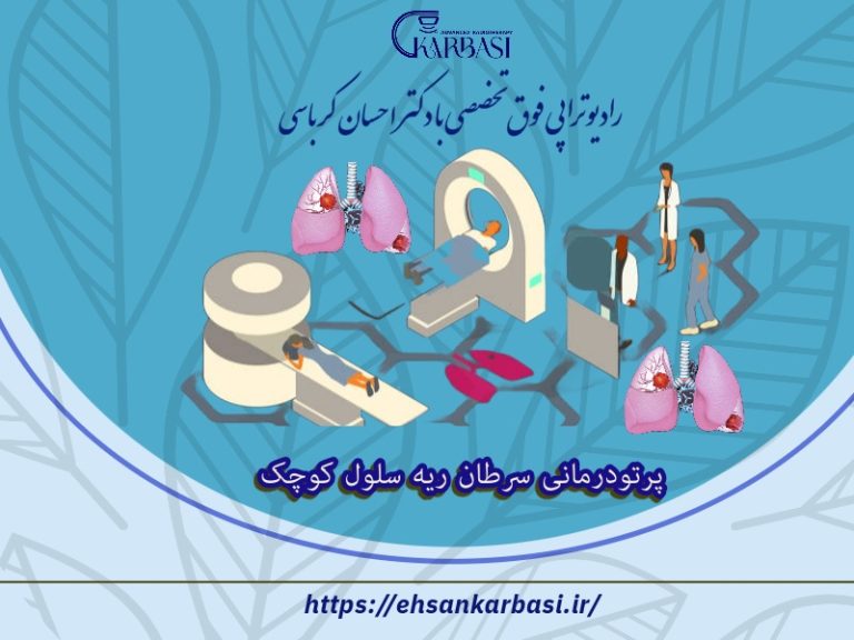 پرتودرمانی سرطان ریه سلول کوچک​