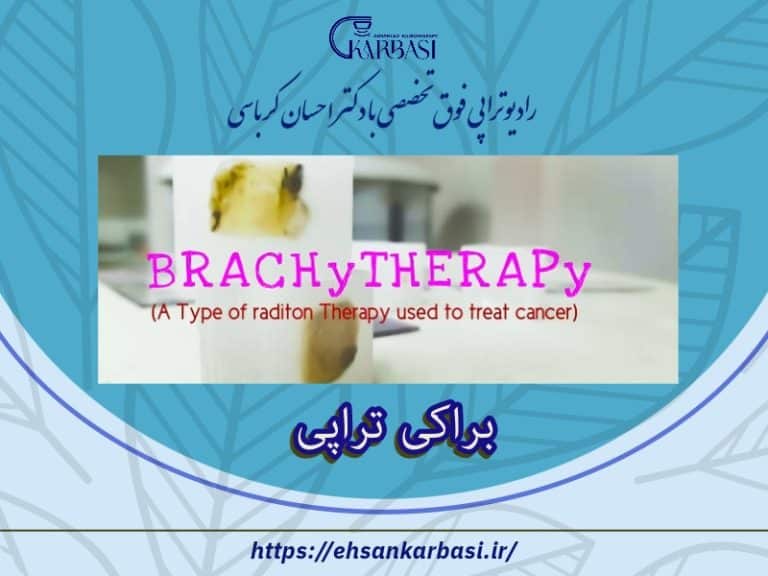 براکی تراپی: درمان سرطان با پرتودرمانی داخلی 2 براکی تراپی