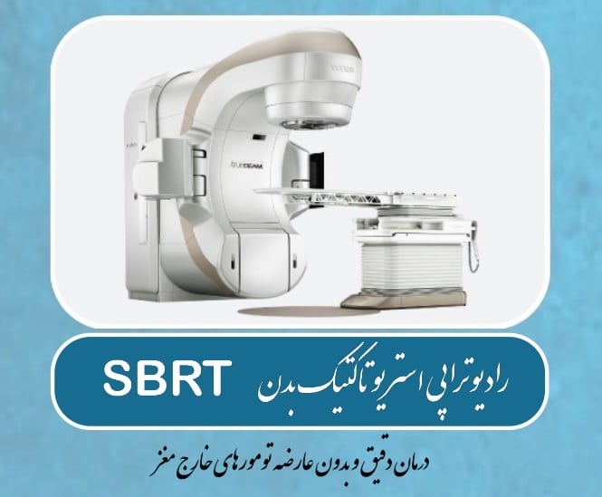 رادیوتراپی استریوتاکتیک بدن