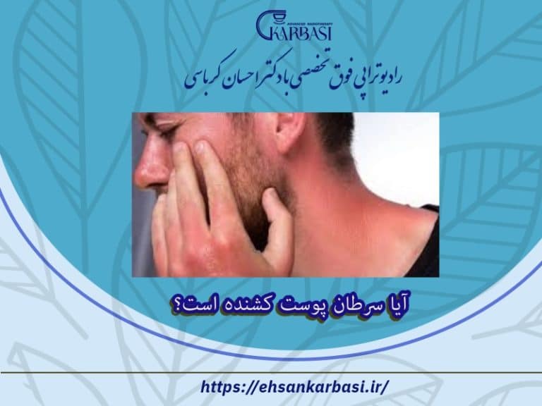 آیا سرطان پوست کشنده است؟ 2 آیا سرطان پوست کشنده است؟