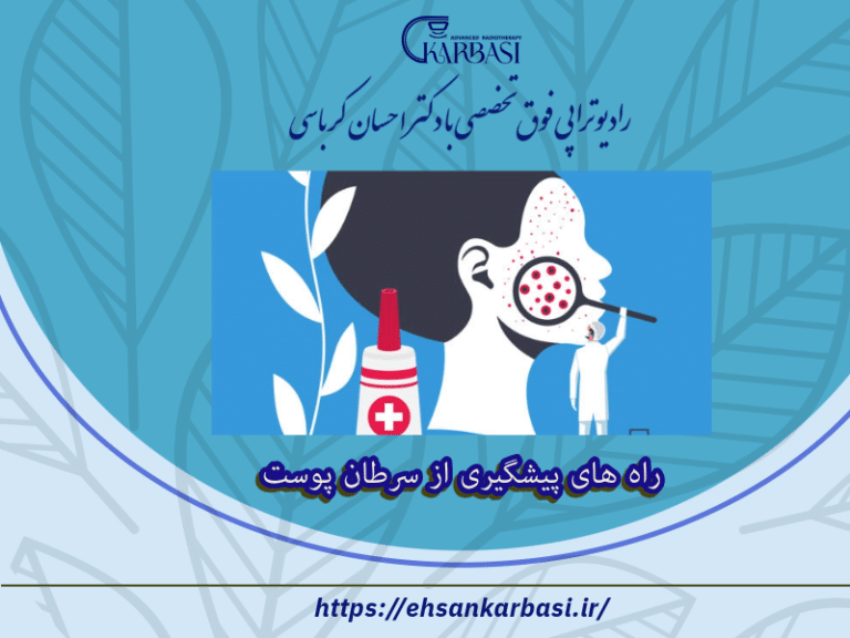 راه های پیشگیری از سرطان پوست 2 راه های پیشگیری از سرطان پوست