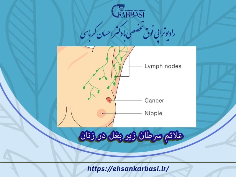 عکس علائم سرطان زیر بغل در زنان