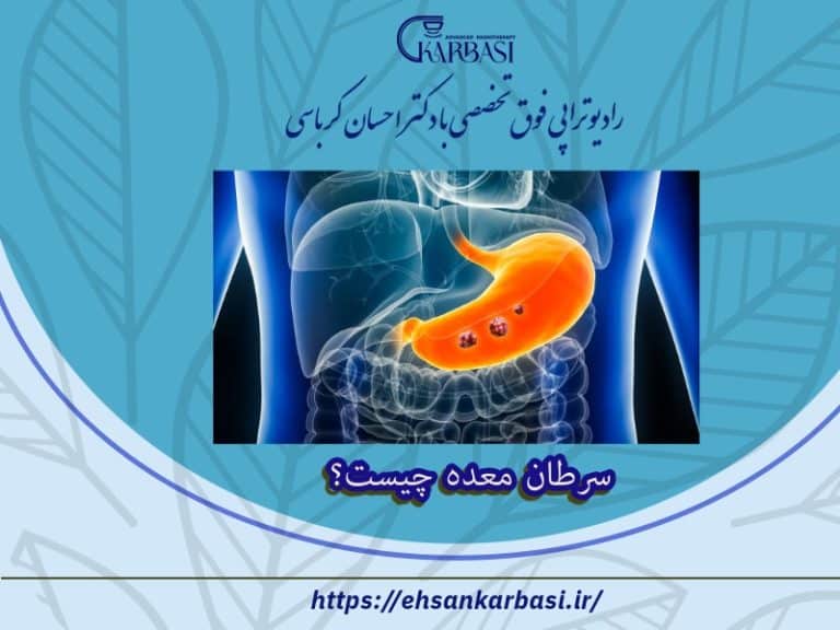 سرطان معده چیست؟ علائم و نشانه های آن 2 سرطان معده چیست؟