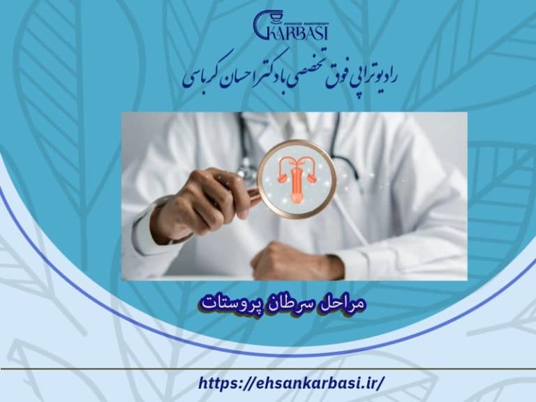 مراحل سرطان پروستات + نکات مهم 2 مراحل سرطان پروستات