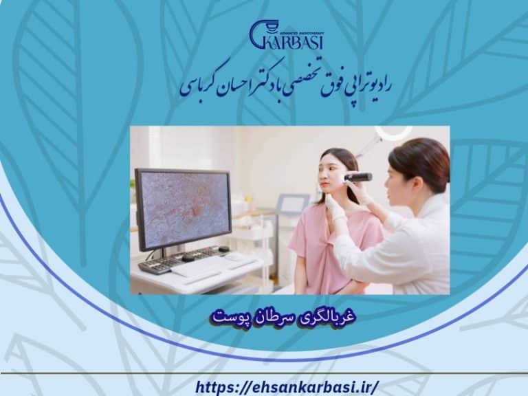 غربالگری سرطان پوست 2 غربالگری سرطان پوست
