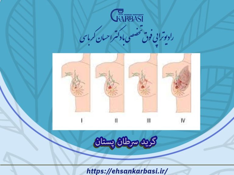 همه چیز درباره گرید سرطان سینه 2 گرید سرطان سینه