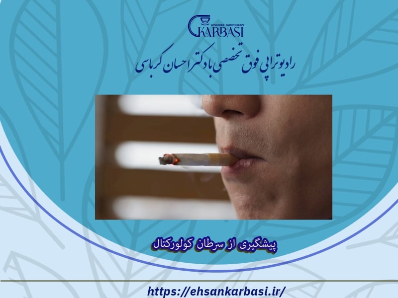 پیشگیری از سرطان کولورکتال