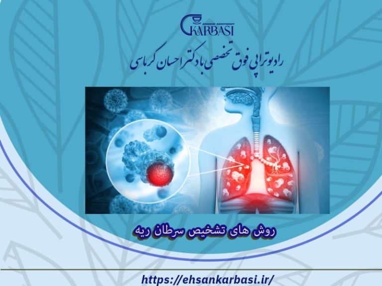 روش های تشخیص سرطان ریه با تست ها و آزمایشات مختلف 2 روش های تشخیص سرطان ریه