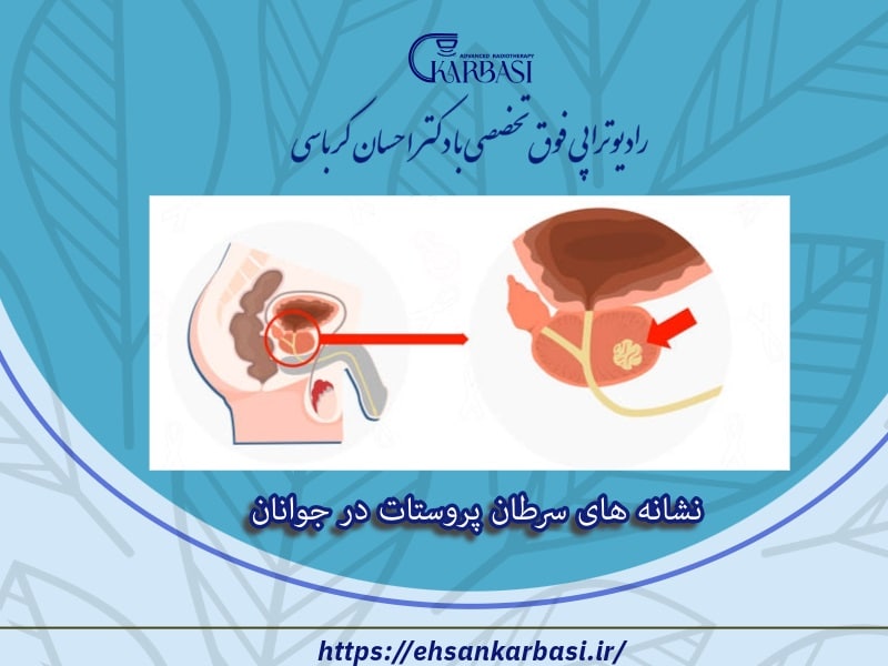 نشانه های سرطان پروستات در جوانان