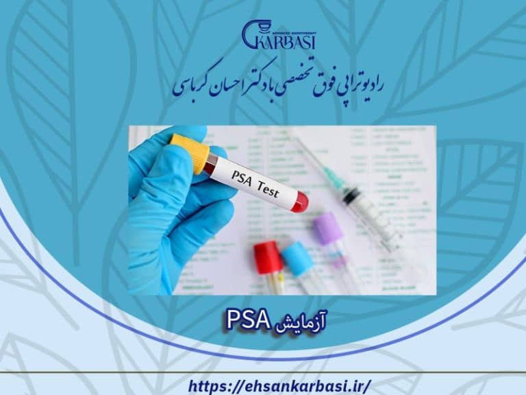 آزمایش PSA چیست و کاربرد PSA در تشخیص سرطان پروستات 2 PSA آزمایش