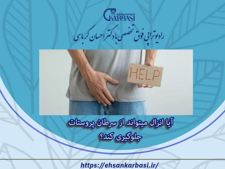 آیا انزال میتواند از سرطان پروستات جلوگیری کند؟ 2 آیا انزال میتواند از سرطان پروستات جلوگیری کند؟