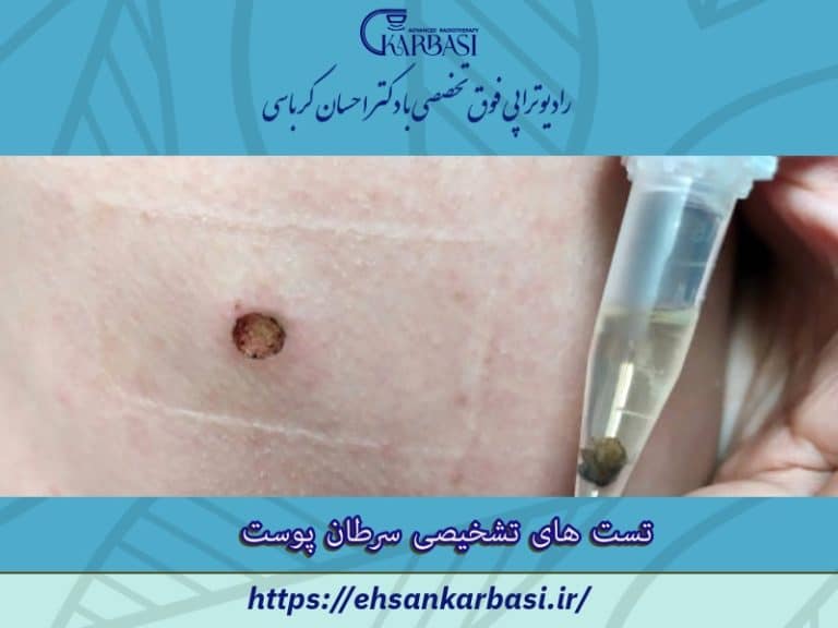 آزمایش های تشخیصی سرطان پوست 2 آزمایش های تشخیصی سرطان پوست