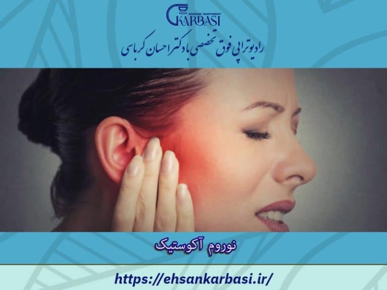 نوروم آکوستیک (شوانوم): علائم و درمان تومور عصب شنوایی 2 نوروم آکوستیک